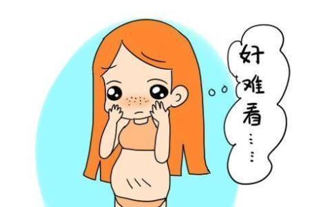 妊娠纹的症状