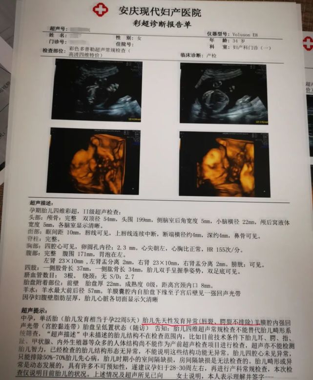 图为汪女士彩超诊断报告单,显示胎儿先天性发育异常(唇裂,腭裂不排除)