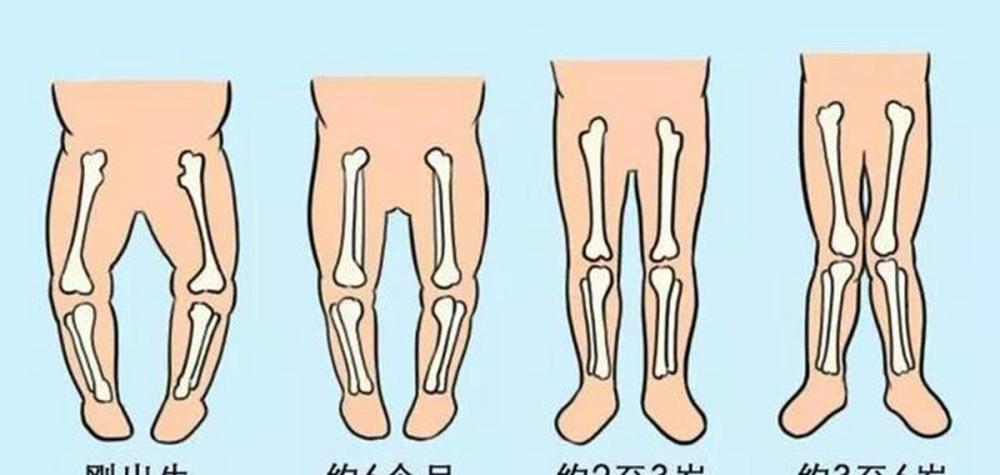 三种行为可能会影响宝宝腿型发育家长不当回事宝宝会遭罪