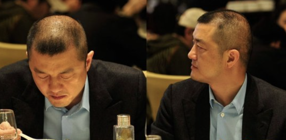 中年男星秃头灾情惨重头顶稀疏能反光后脑勺都没几根毛