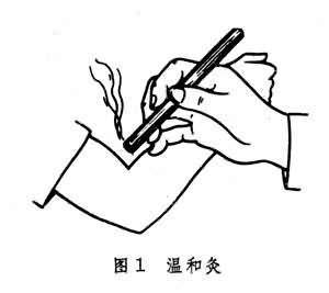 雀啄灸在施灸时同样需要将艾条一端点燃,但并不固定距离,反而会