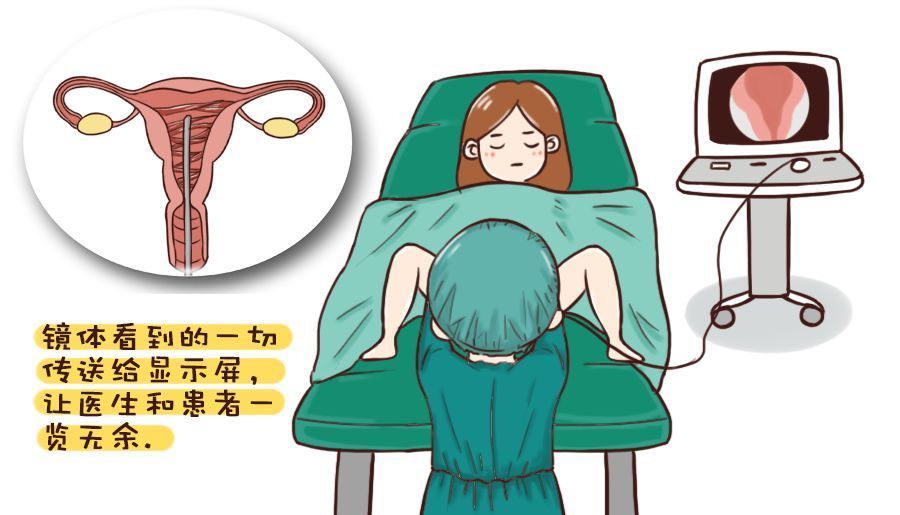 贝安健康:宫腔黏连常见的治疗方式