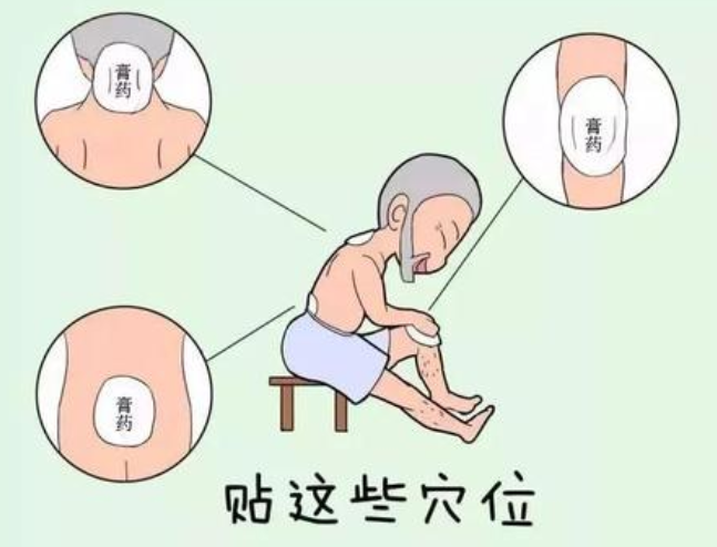 气温骤降,65岁老人膝盖疼痛,自行贴膏药竟导致接触性皮炎