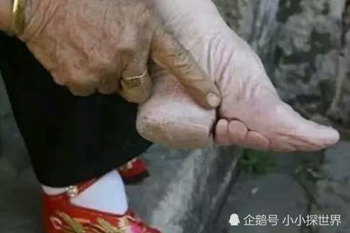 裹脚:所谓三寸金莲的背后,是古代中国人的畸形审美