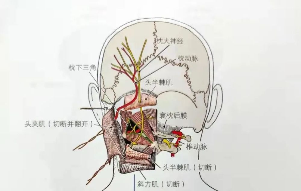 一咳嗽就头痛可能是枕大神经受损处理时注意这5个关键点