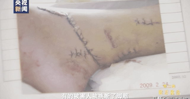 厅级"黑老大":敛财百亿,坐拥2714套房,手下曾挑脚筋,剁手指