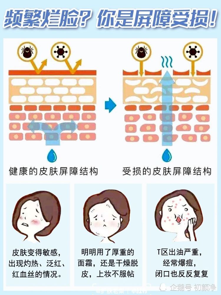 80%的人皮肤屏障受损了,还以为只是普通过敏!