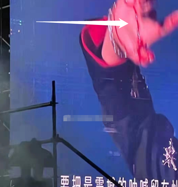 张杰演唱会突发舞台事故因升降台故障摔倒
