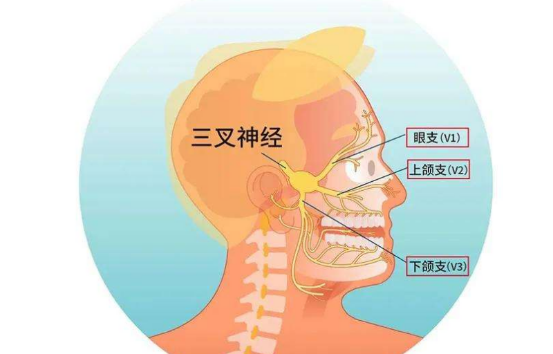 三叉神经痛是在太疼,这些原因要知道,如何缓解?