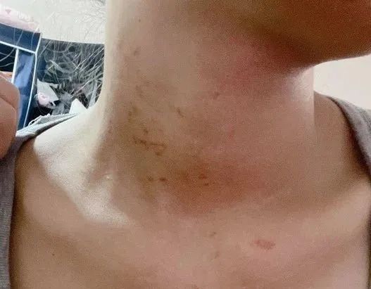 脖子挂"草莓项链",同事误会!网友羡慕:满满的爱呀