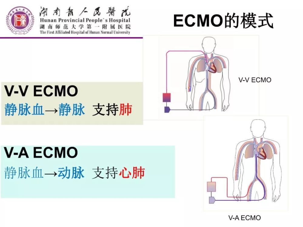 pptecmo模式和生理