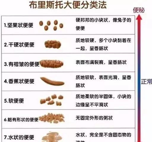 每天这个时间排便的人可能更长寿你是其中之一吗