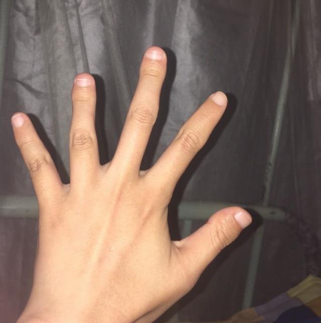 女明星拍写真,为何很少露出大拇指?