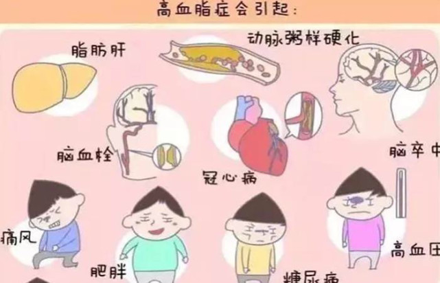 艾灸调理高血脂