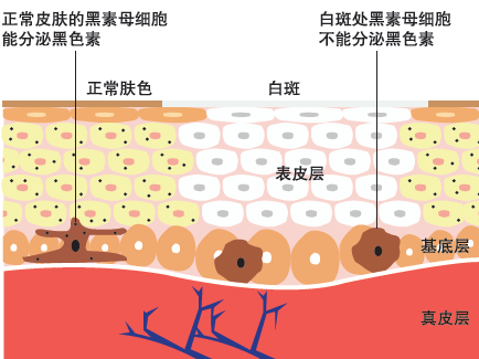 黑色素是如何形成的?