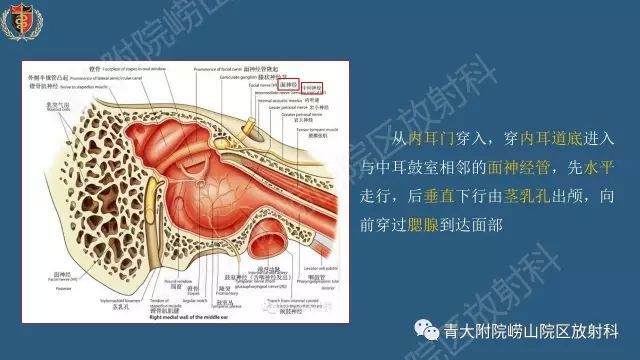 面神经影像解剖