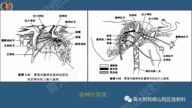 面神经影像解剖