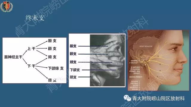 面神经影像解剖