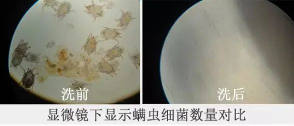 变态氨基酸洁面乳!5秒揉一揉,螨虫全了