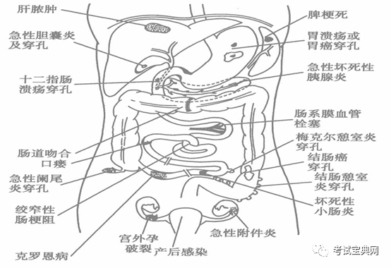 2)腹腔内急性炎症和感染:急性阑尾炎,急性胆囊炎,急性胰腺炎,坏死性