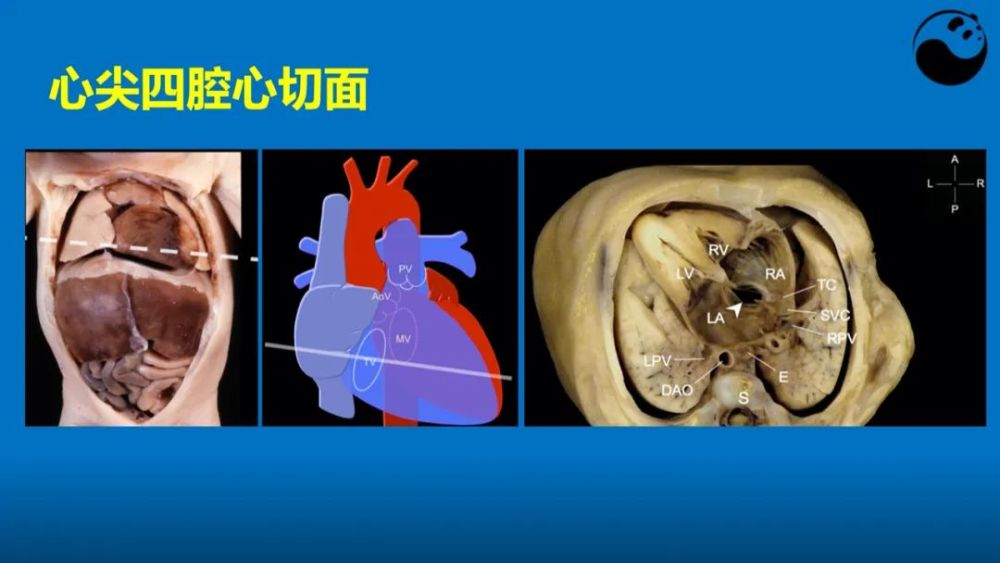 学好超声心动图,应掌握的心脏解剖知识