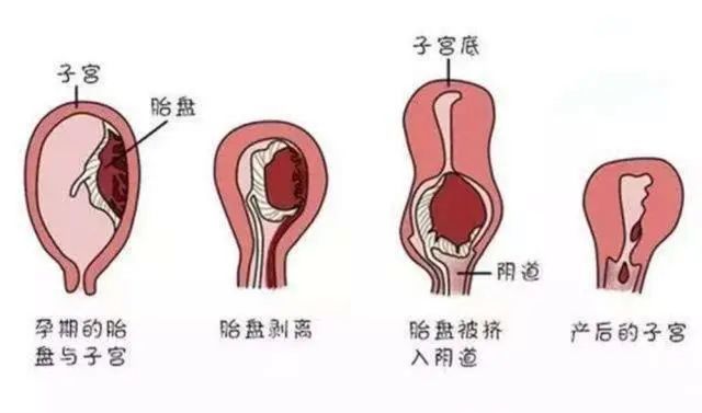 顺产后恶露多久干净期间要注意什么