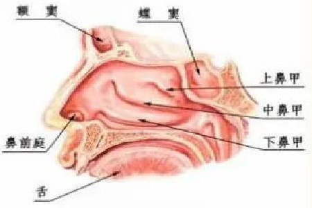 萎缩性鼻炎的症状表现1,鼻塞:脓痂堵塞鼻腔可致鼻塞,或因鼻粘膜的