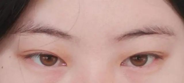 明明都是割出来的双眼皮,为什么有人的却更自然更好看