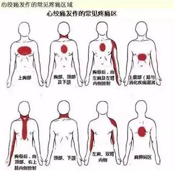 绞痛所导致的胸痛部位大多是在心前区或者肋骨后,有时会随着疼痛加重