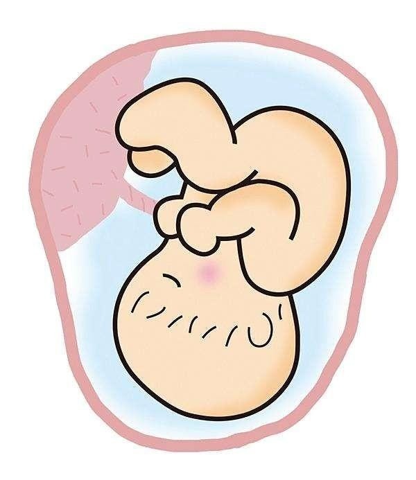 脐带过短怎么办,对宝宝出生有影响吗?