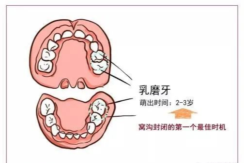 612岁换牙期问题孩子能不能有一口好牙关键就看这几点