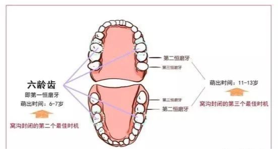 612岁换牙期问题孩子能不能有一口好牙关键就看这几点