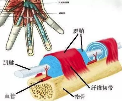 腱鞘炎的早期症状有哪些