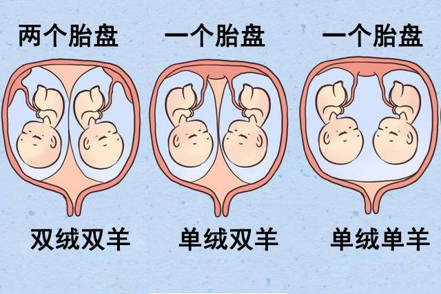 妊娠几周可听到胎心音_多胎妊娠_怀孕51天妊娠囊外形不规则,有胎芽及胎心波动