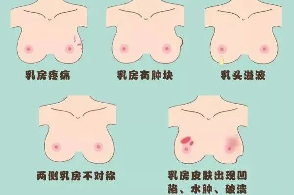 观察乳头皮肤有无瘙痒,糜烂,结痂,脱屑,乳晕有无水肿.