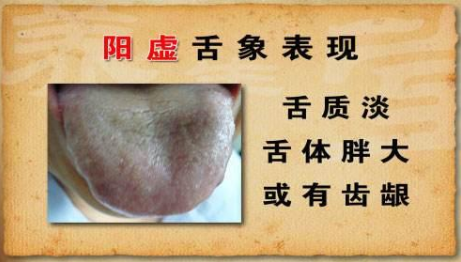 教你如何区分"阴虚"和"阳虚",一学就会!一调就好!
