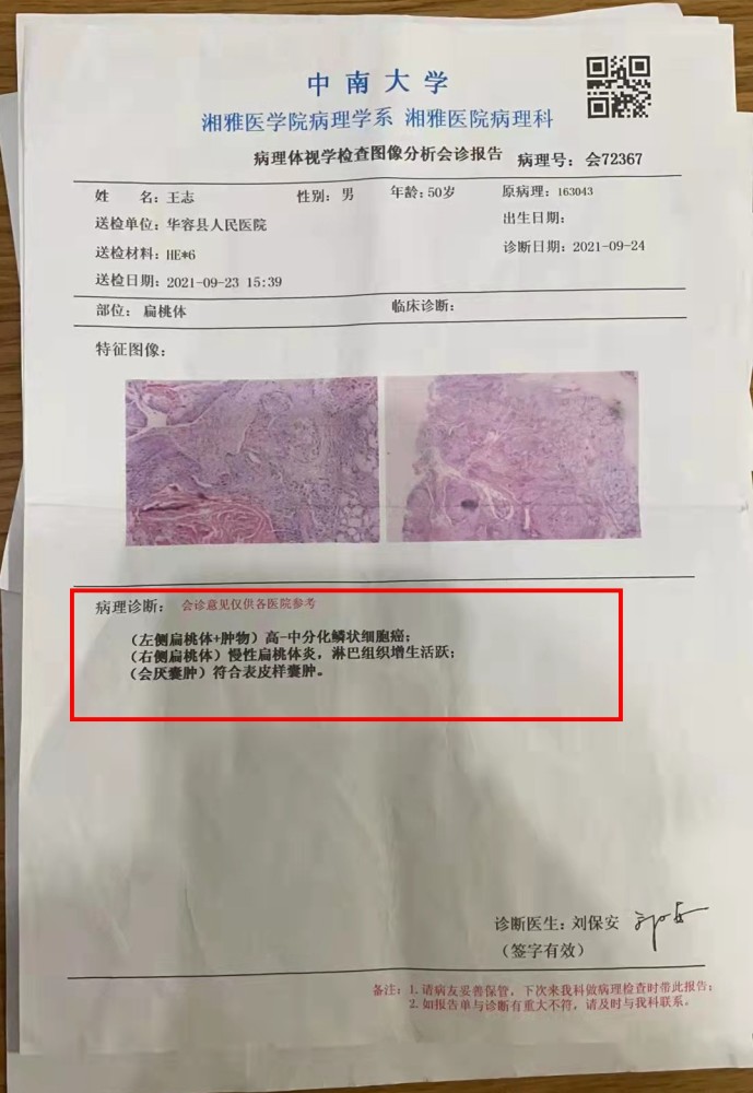 后马上安排到湖南省肿瘤医院进行进一步检查确认,原计划给扁桃体摘除