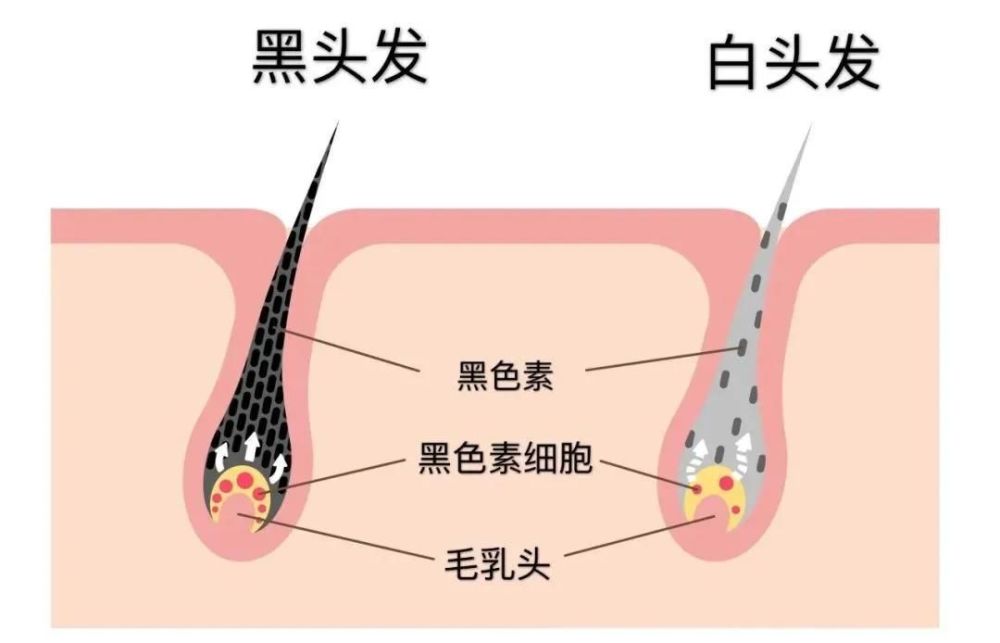 代谢缓慢的同时,对于头发供给的微量元素越少,导致头皮中的黑色素细胞