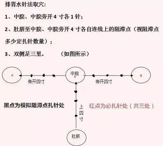 怪病痰作祟排痰针法