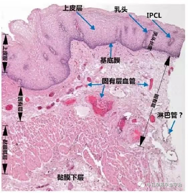 由多层的鳞状上皮细胞组成,上皮层的最下方为基底膜,它将上皮层和固有