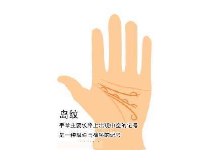 一般来说,岛纹存在五大线纹之上,大多寓意都不是很好.