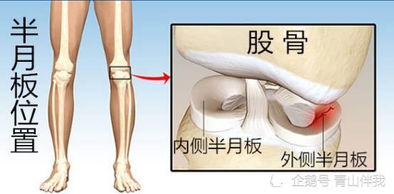 半月板损伤怎么治疗比较好