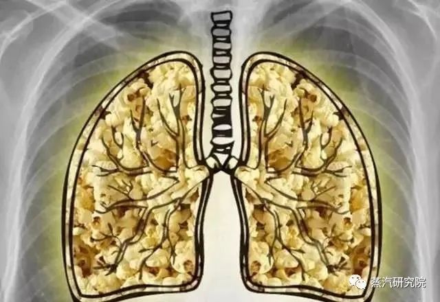 爆米花肺有症状,是什么原因引起?跟电子烟有什么关系?