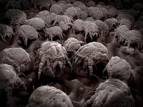 人体皮肤一厘米的区域居然有1000万个微生物好脏呀
