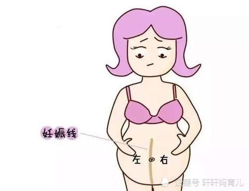 怀孕后肚子上出现的那条黑线是什么?