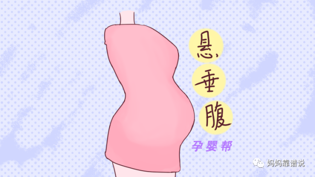悬垂腹是什么?悬垂腹就是通常所说的怀孕期间腹部下垂.