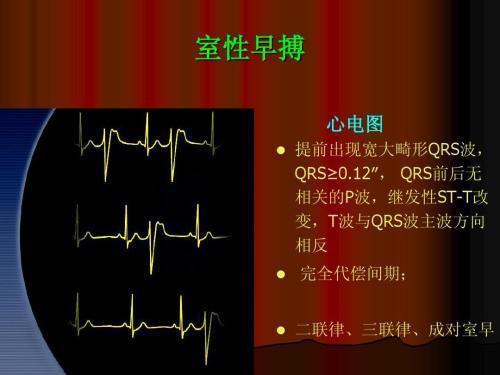 房室交接区逸搏和逸搏心律,主要的发病原因是什么?如何治疗?