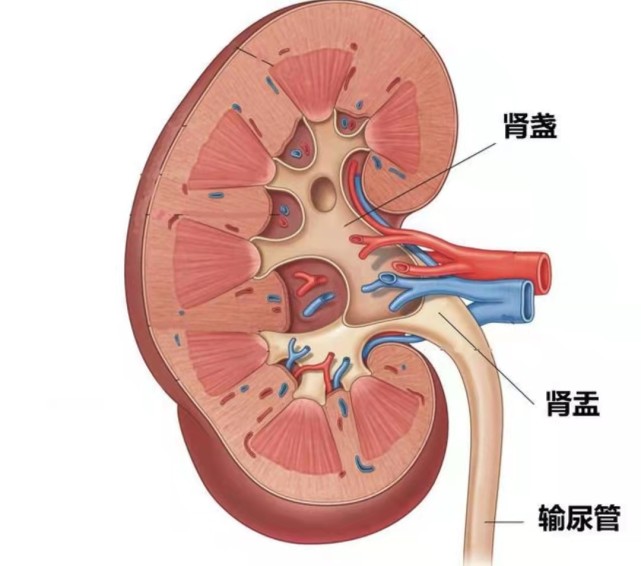 (1)肾脏解剖结构:肾盂肾盏之间存在的夹角是导致各种腔镜碎石术后结石