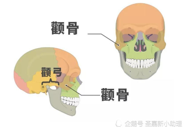 北京改脸型医生张笑天:颧骨内推术的切口在哪里?_腾讯