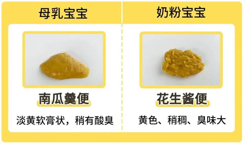 宝宝刚开始喝奶粉,头十天发现每天都要拉四五次,还是绿色的糊状便便